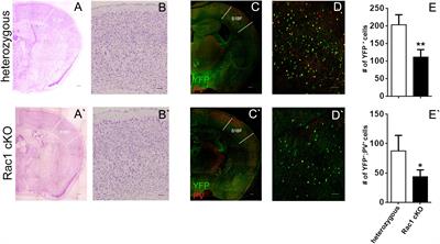 Mice With Decreased Number of Interneurons Exhibit Aberrant Spontaneous and Oscillatory Activity in the Cortex